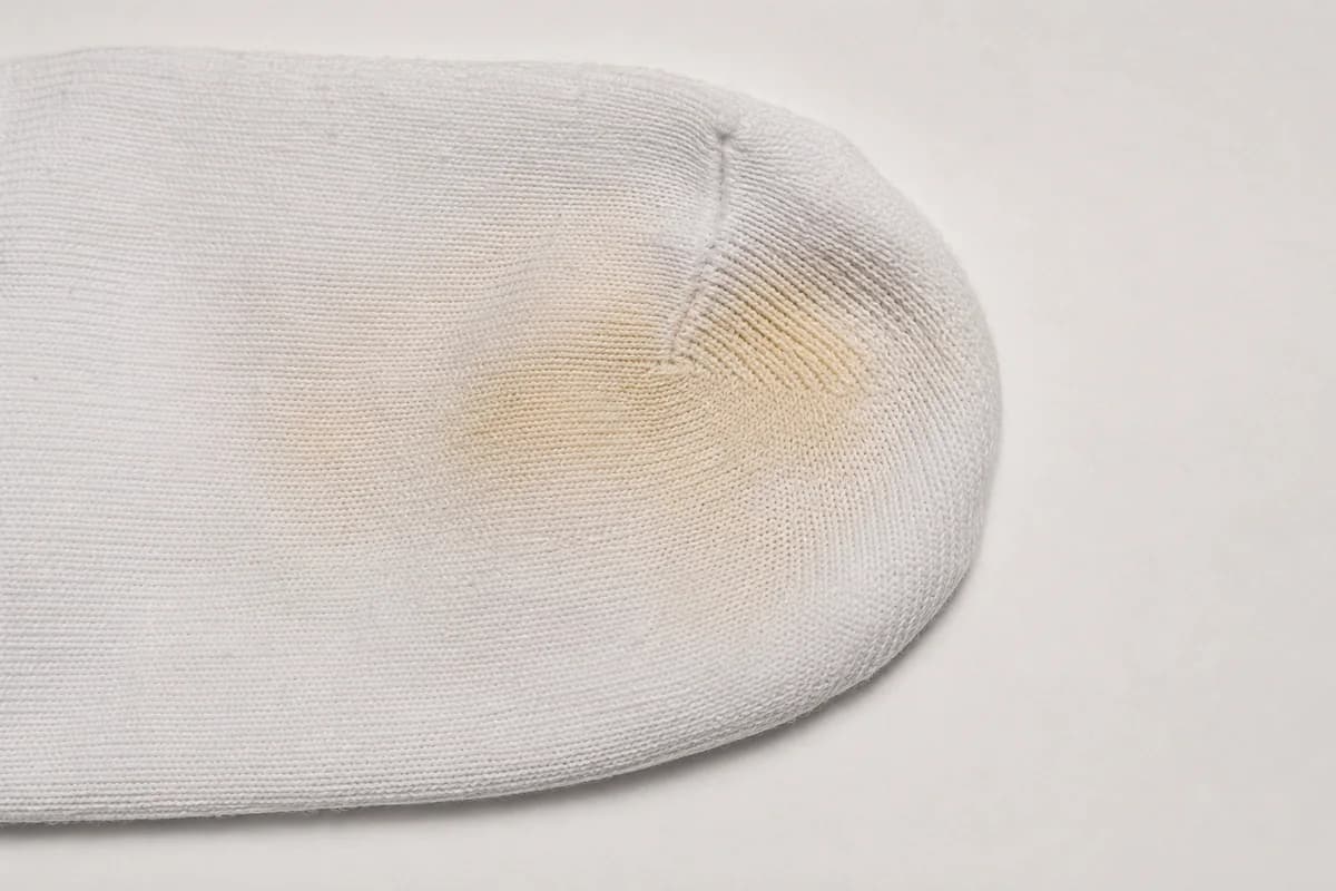 Close detail of the toe end of a white sock showing a soft-edged warm yellow zone in the knit.